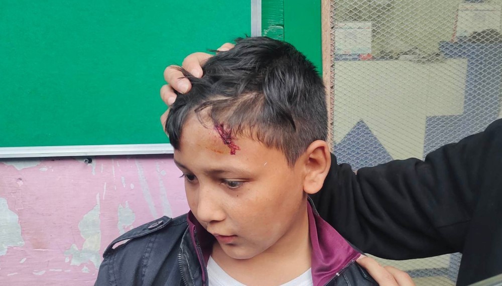 भारतीयले हानेको ढुङगा लागेर नेपाली बालक घाईते ।